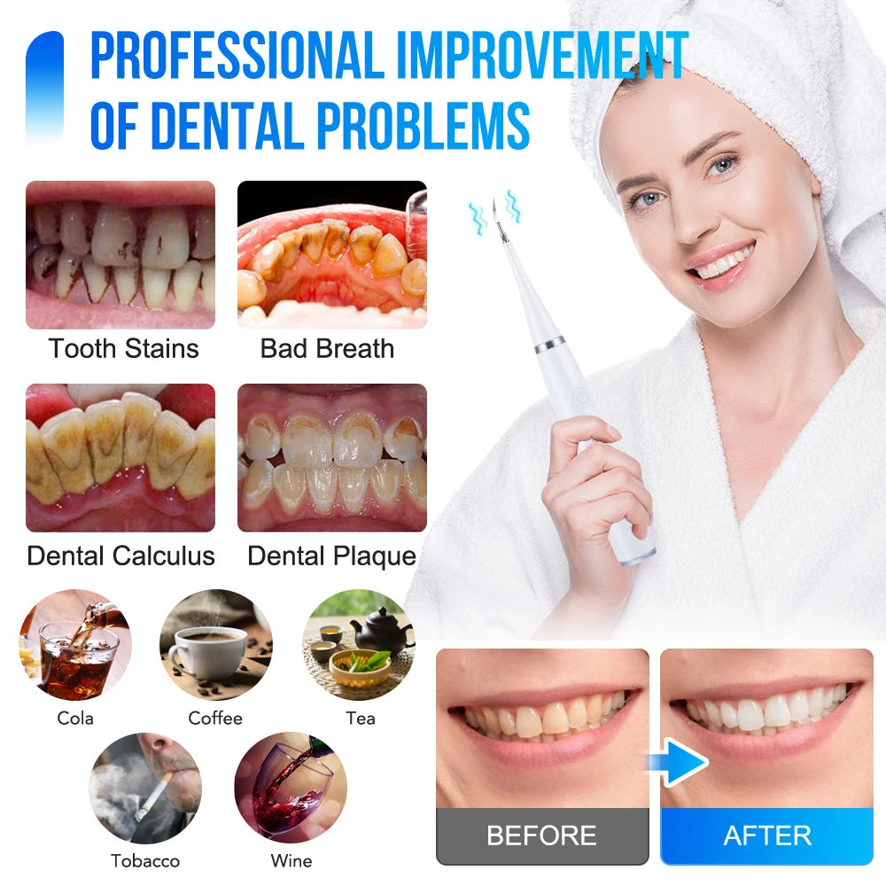 Electric Dental Calculus Remover – Ultrasonic Dental Scaler & Teeth Whitening Kit